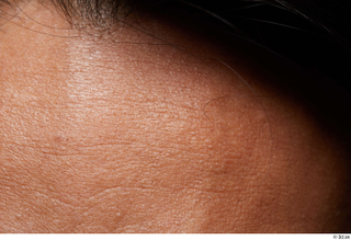 HD Face Skin Moises Molina forehead hair skin pores skin…